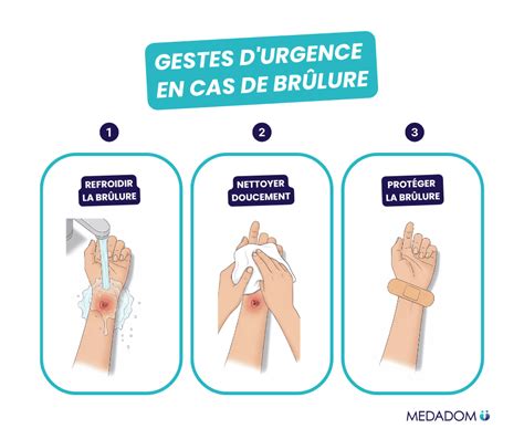 Schéma des gestes premiers secours pour brûlures mineures