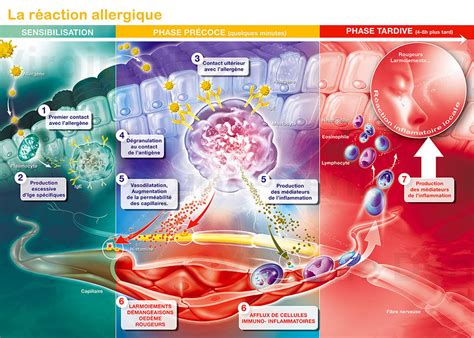 Illustration des symptômes d'une réaction allergique cutanée