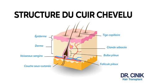 Schéma d'un follicule pileux enflammé