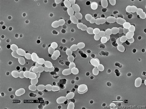 Microscopie de bactéries lactiques