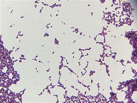Microscopie de Brevibacterium linens