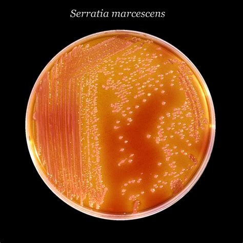 Colonies de Serratia marcescens sur gélose
