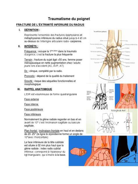 diagramme anatomie poignet et fractures