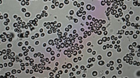 Microscope montrant des bactéries et des levures