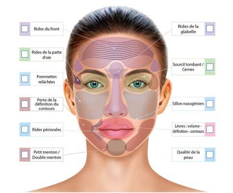 Schéma des zones du visage sujettes aux points noirs et conseils de traitement