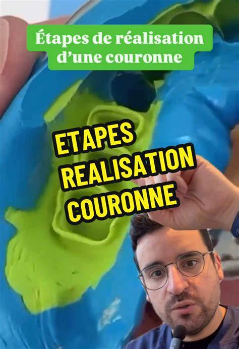Scheme des étapes et textures souhaitées