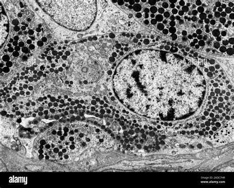 Micrographie électronique de bactéries