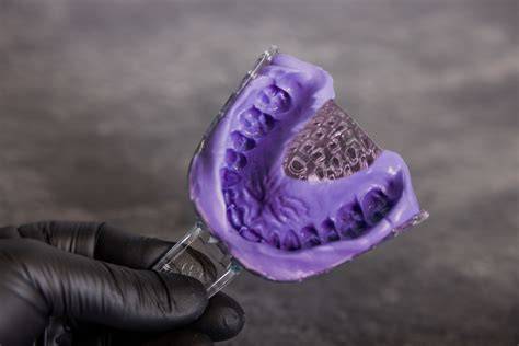 Schéma comparatif des matériaux d'empreinte: alginate, PVS, polyéther, balayage numérique
