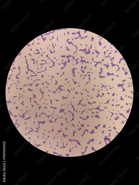 Microscope view of lactic acid bacteria