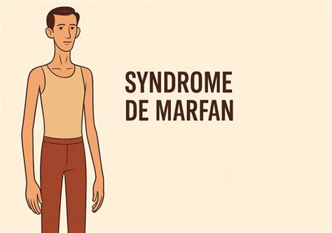 Graphique sur le syndrome de Marfan: prévalence et gène FBN1