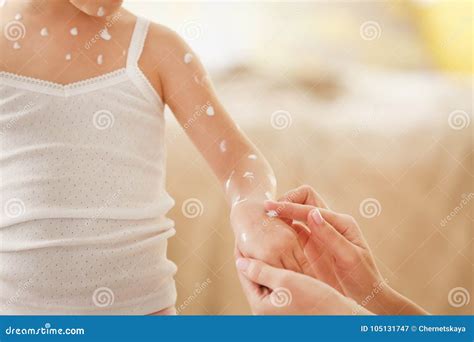 Une main appliquant une crème apaisante sur une égratignure légère