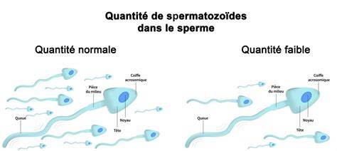 Infographie: diminution de la concentration de spermatozoïdes entre 1989 et 2005